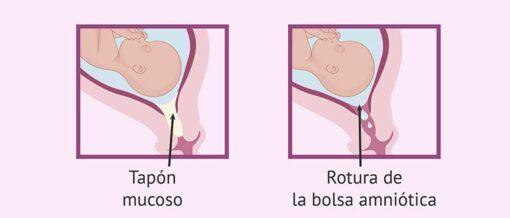 La importancia del tapón mucoso en tu embarazo El blog de Mundo Petit